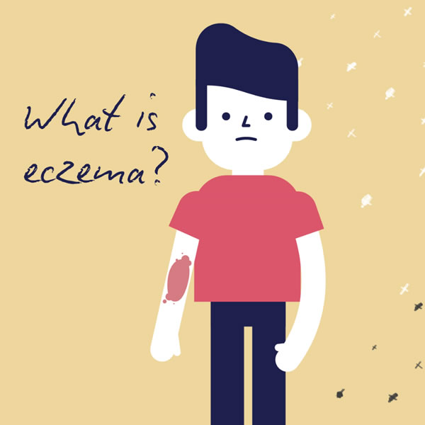What is eczema