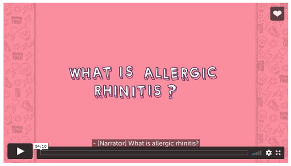 Allergic rhinitis (hay fever)