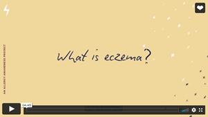 NAS what is eczema adults